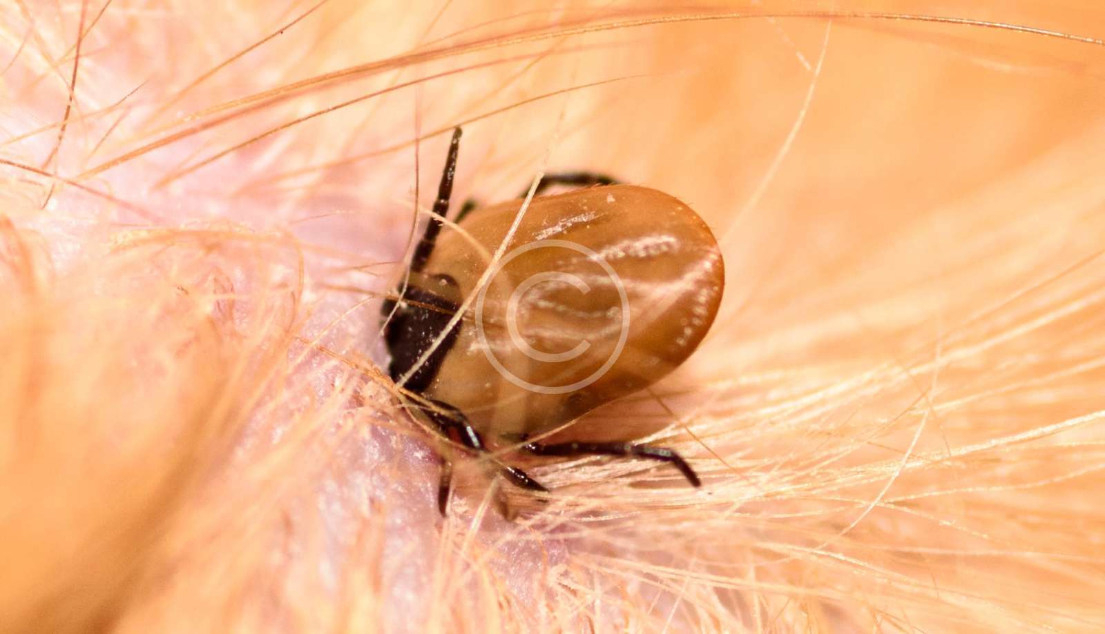 Ticks
